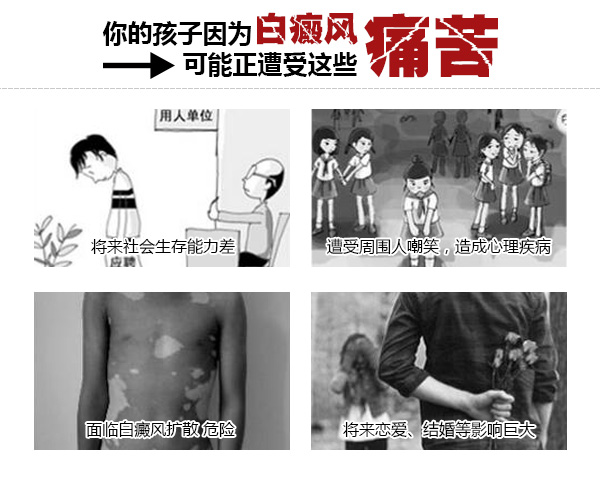 白癜风的危害有什么
