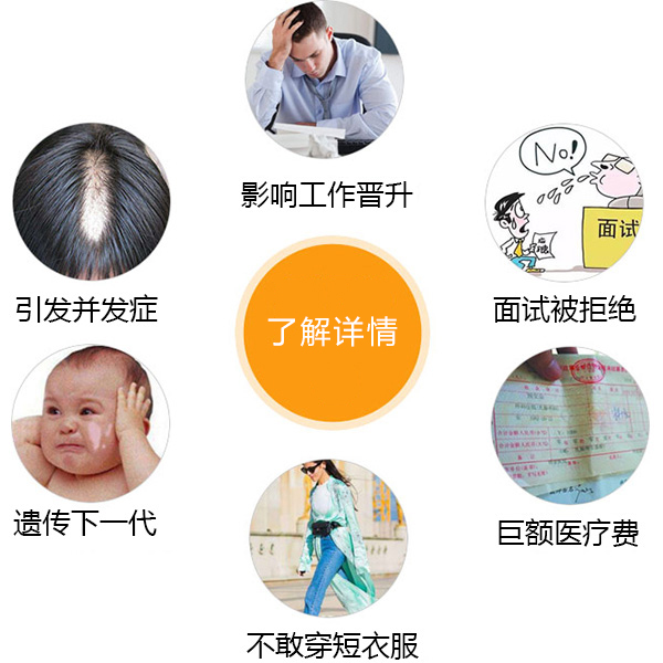 白癜风可能会引起哪些并发症呢