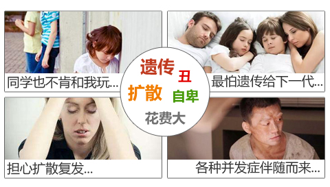 白癜风对身体的危害