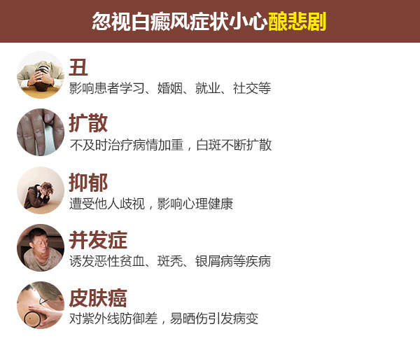 男性头部患白癜风有哪些危害