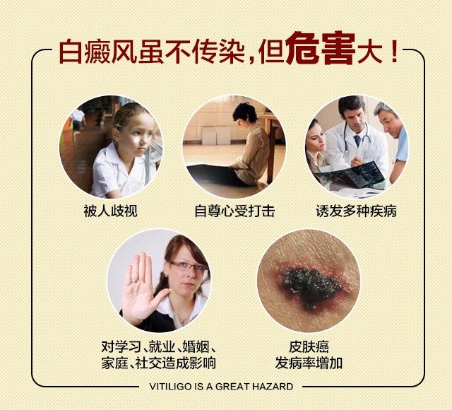 白癜风的危害有些什么
