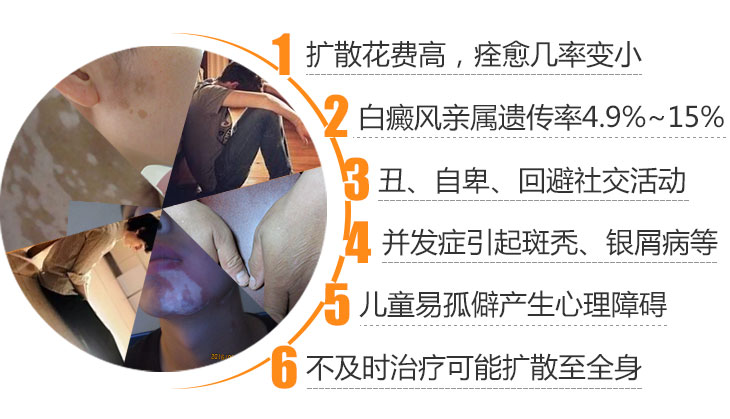 青少年白癜风有哪些严重的危害呢