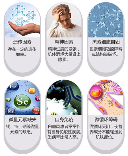 皮肤出现白癜风的原因是什么