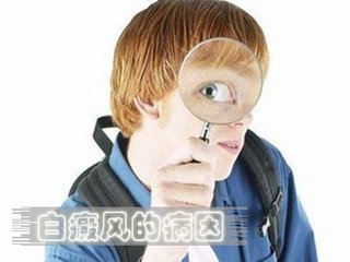苏州压力大也是引起白斑的诱因吗