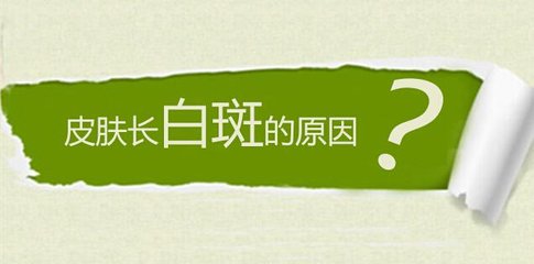 白癜风病因有关因素有哪些呢