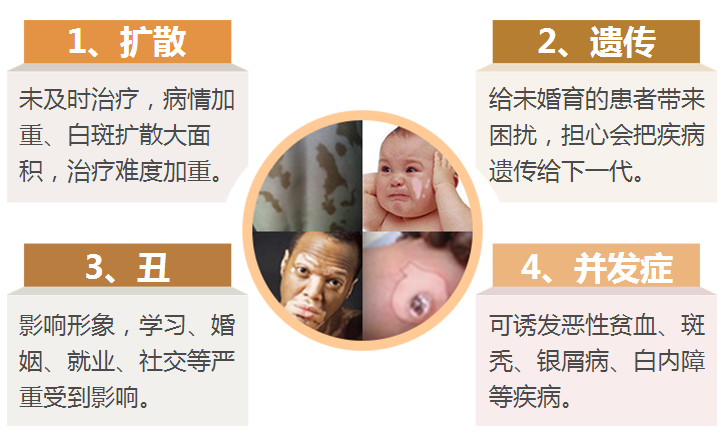 白癜风的危害主要表现在哪些方面