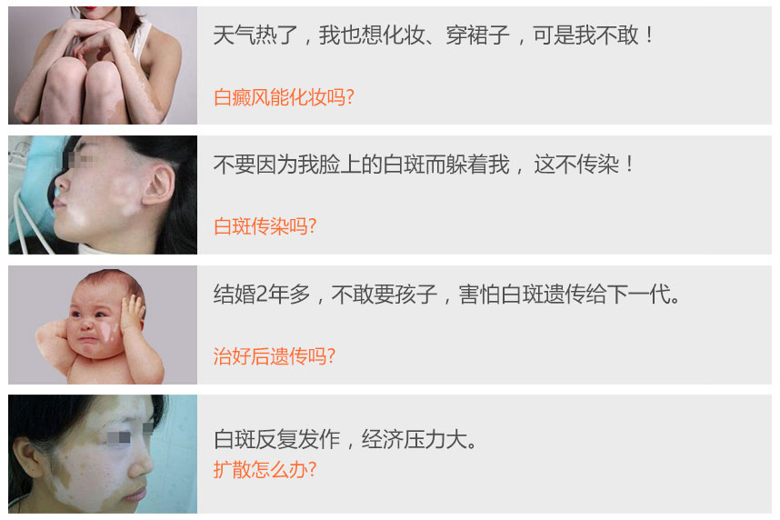 白癜风会给患者带来哪些严重的伤