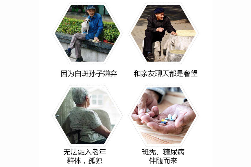 白癜风造成的主要危害会有哪些呢