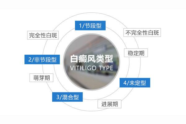 不同类型的白癜风有哪些症状表现