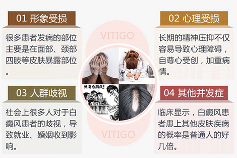 患上白癜风会有什么危害呢