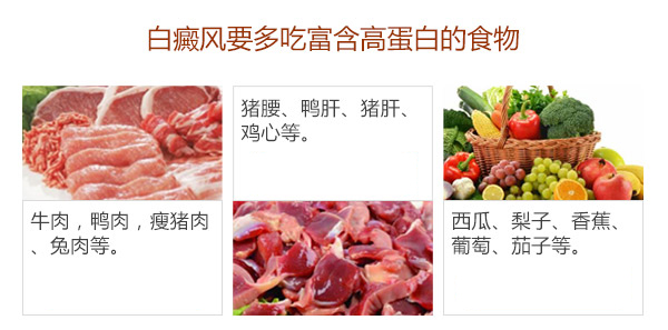 睡眠质量差会影响白癜风