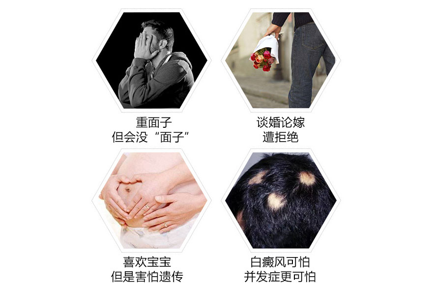 白癜风主要可能会带来哪些危害
