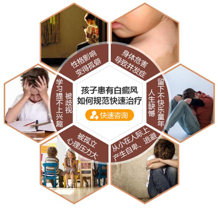 盐城白癜风医院