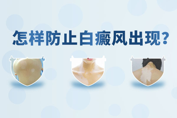 泰州最好的白癜风专科医院