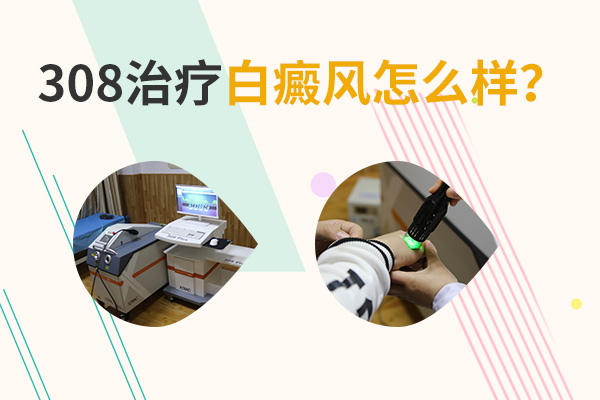 白白没发展可以用手术治疗吗？ 南昌治疗白癜风好的医院