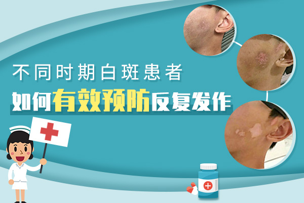 治疗白癜风应该避免哪些误区?