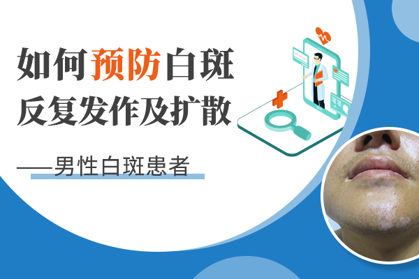 该怎么预防男性白癜风才好？