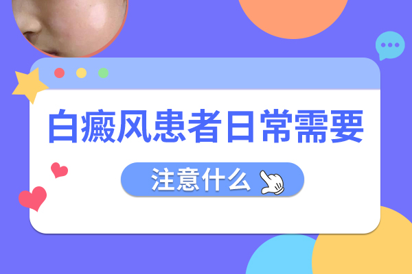 女性患手部白癜风要注意什么?