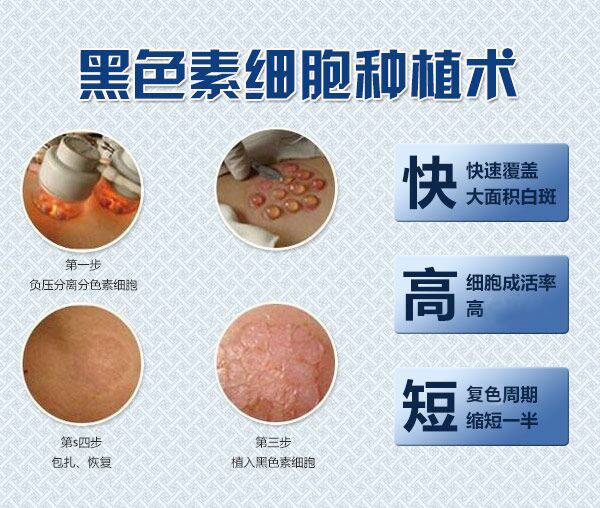 近朱者赤近我者黑——黑色素細胞種植療法