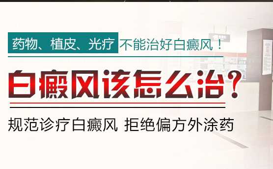 白癜风应该如何采取正确治疗方法