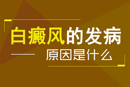 白癜风病因