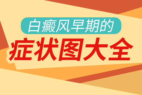 白癜风都有哪些症状