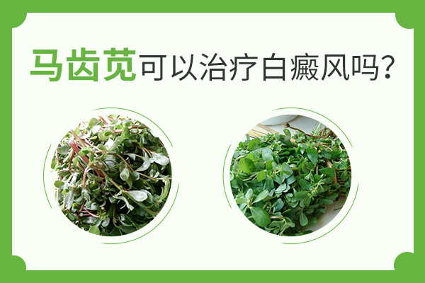 马齿苋可以治疗白癜风吗？