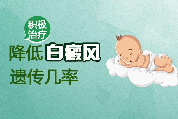 海口哪个白癜风医院好 如何降低白癜风遗传几率