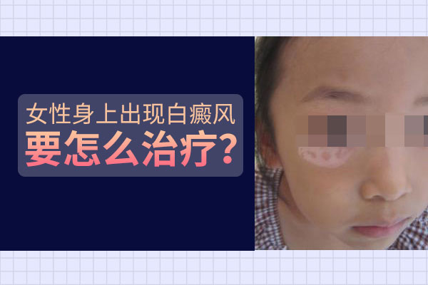 怎样治疗女性白癜风效果才更好?