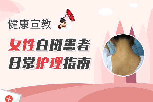 女性白癜风如何进行日常护理?