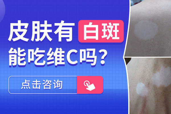 为何不建议白癜风患者摄入过多的维C？