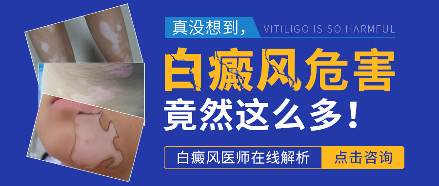隐性白斑有哪些特点?
