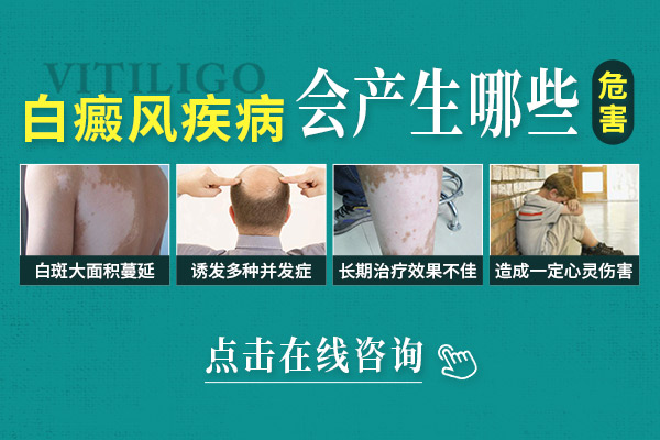 南京有治白癜風的醫院有哪些-胳膊上的白斑不治療有什么危害